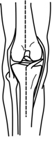 Knee in alignment