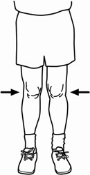 knees pointing inward