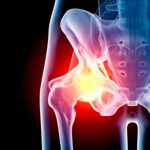 How To Fix Hip Pain, Do you suffer from hip pain? read on to find out how to fix